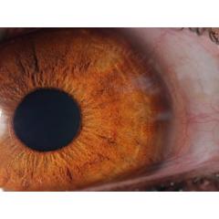 Fotografie lidského oka (3. etapa)